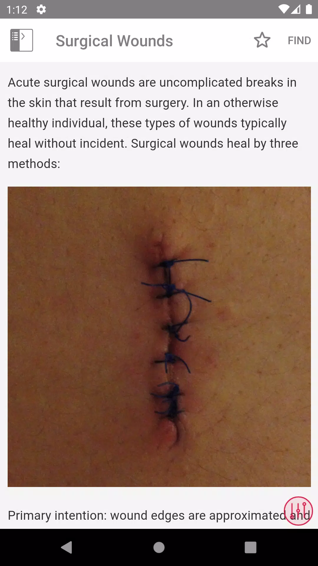Wound Care MI Visual Tangkapan skrin 3