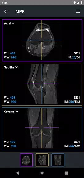 IDV - IMAIOS DICOM Viewer應用截圖第3張