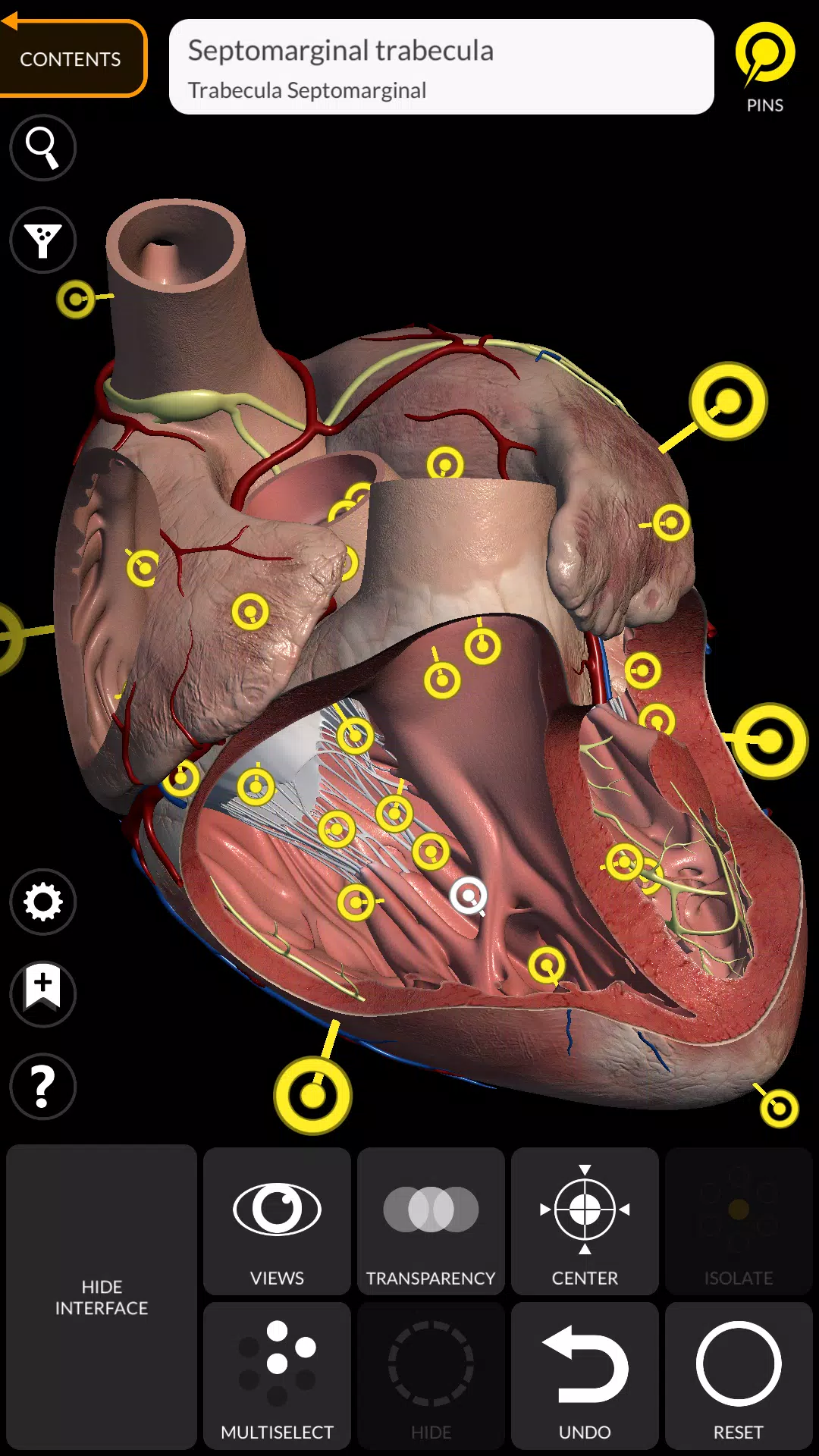Anatomy 3D Atlas應用截圖第2張